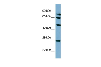 SV2B Rabbit Polyclonal Antibody
