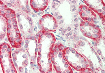 SV2A Rabbit Polyclonal Antibody
