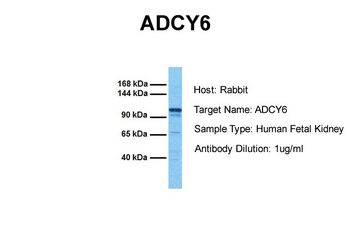 ADCY6 Rabbit Polyclonal Antibody
