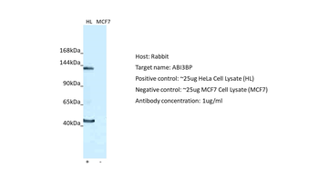 ABI3BP Rabbit Polyclonal Antibody