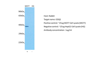 COQ2 Rabbit Polyclonal Antibody