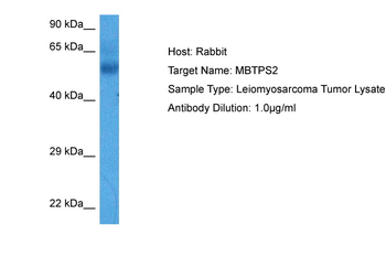 MBTPS2 Rabbit Polyclonal Antibody