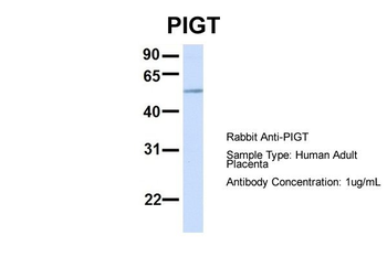 PIGT Rabbit Polyclonal Antibody
