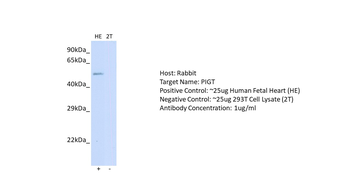 PIGT Rabbit Polyclonal Antibody