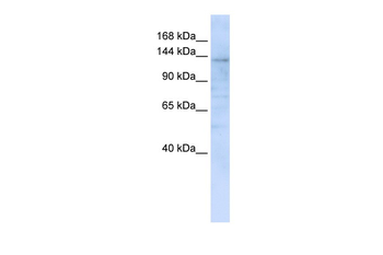 IMPG2 Rabbit Polyclonal Antibody