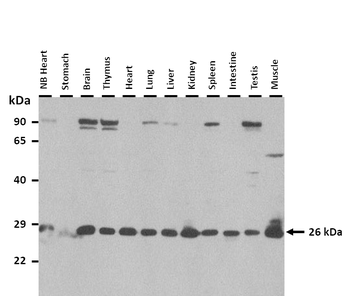 Clec1b Rabbit Polyclonal Antibody