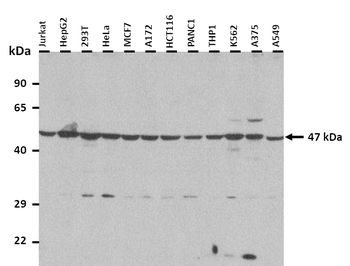 A4GALT Rabbit Polyclonal Antibody