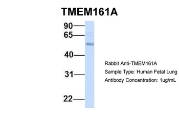 TMEM161A Rabbit Polyclonal Antibody