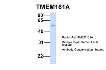 TMEM161A Rabbit Polyclonal Antibody