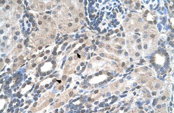 PIGV Rabbit Polyclonal Antibody