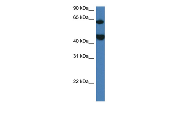 Lpcat2 Rabbit Polyclonal Antibody