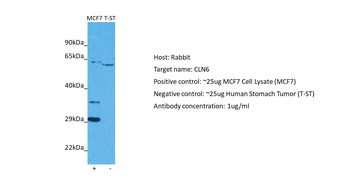 CLN6 Rabbit Polyclonal Antibody