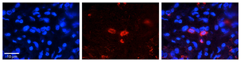 CLN6 Rabbit Polyclonal Antibody