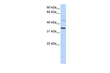 CLN6 Rabbit Polyclonal Antibody