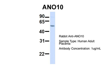 TMEM16K Rabbit Polyclonal Antibody