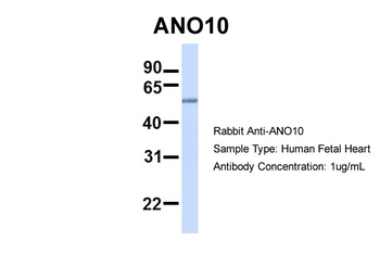 TMEM16K Rabbit Polyclonal Antibody