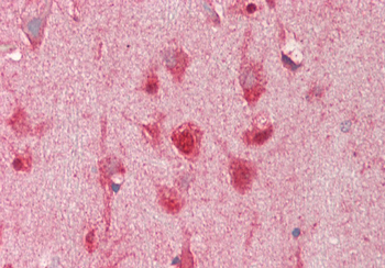 TMEM16K Rabbit Polyclonal Antibody