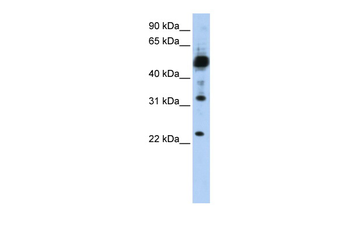 TMEM38B Rabbit Polyclonal Antibody