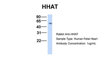 HHAT Rabbit Polyclonal Antibody