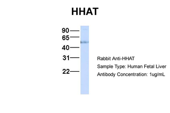 HHAT Rabbit Polyclonal Antibody