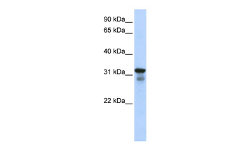LAPTM4B Rabbit Polyclonal Antibody