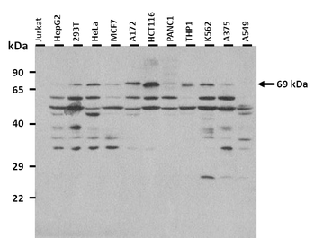 ST6GALNAC1 Rabbit Polyclonal Antibody