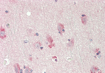 ST6GALNAC1 Rabbit Polyclonal Antibody