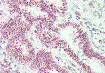 ST6GALNAC1 Rabbit Polyclonal Antibody