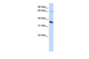 ST6GALNAC1 Rabbit Polyclonal Antibody