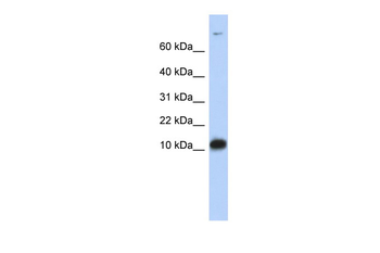 FABP3 Rabbit Polyclonal Antibody