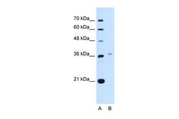LHX8 Rabbit Polyclonal Antibody