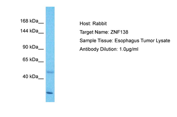 ZNF138 Rabbit Polyclonal Antibody