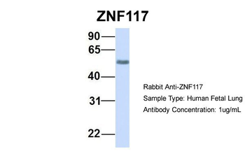 ZNF117 Rabbit Polyclonal Antibody