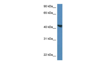 Meis3 Rabbit Polyclonal Antibody