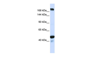 KIAA1618 Rabbit Polyclonal Antibody
