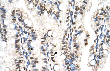 RUNDC2A Rabbit Polyclonal Antibody
