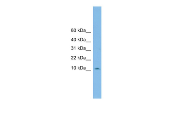 PHF5A Rabbit Polyclonal Antibody