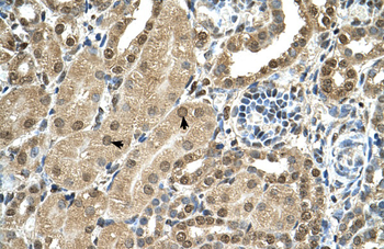 TBX15 Rabbit Polyclonal Antibody