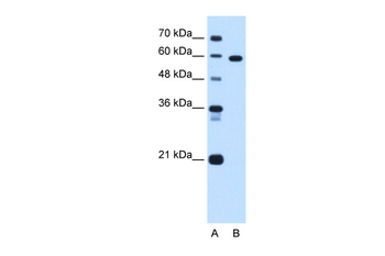TBX15 Rabbit Polyclonal Antibody
