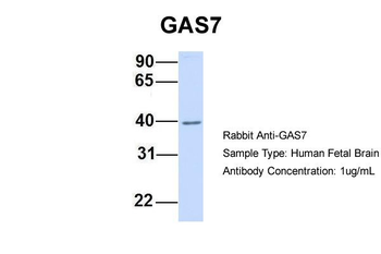 GAS7 Rabbit Polyclonal Antibody