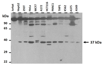 FBP2 Rabbit Polyclonal Antibody