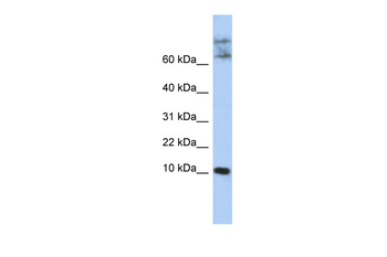 CKLF Rabbit Polyclonal Antibody