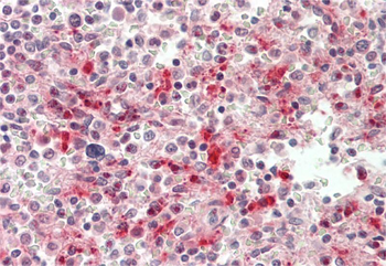 PLAC8 Rabbit Polyclonal Antibody