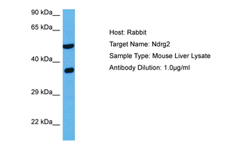 NDRG2 Rabbit Polyclonal Antibody