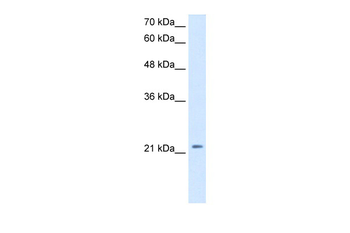 DKK1 Rabbit Polyclonal Antibody