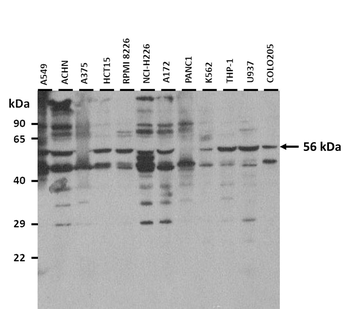 GAS8 Rabbit Polyclonal Antibody