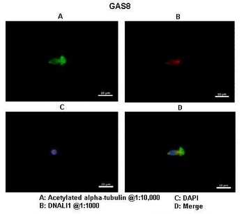 GAS8 Rabbit Polyclonal Antibody