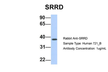 SRRD Rabbit Polyclonal Antibody