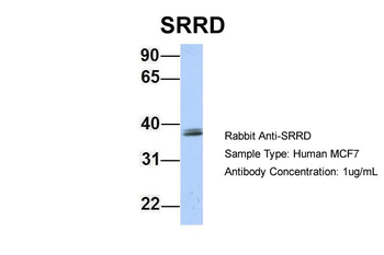 SRRD Rabbit Polyclonal Antibody