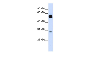 YWHAZ Rabbit Polyclonal Antibody